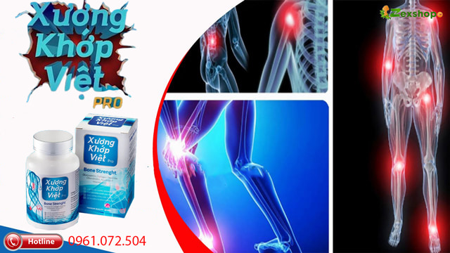 giới thiệu Xương Khớp Việt